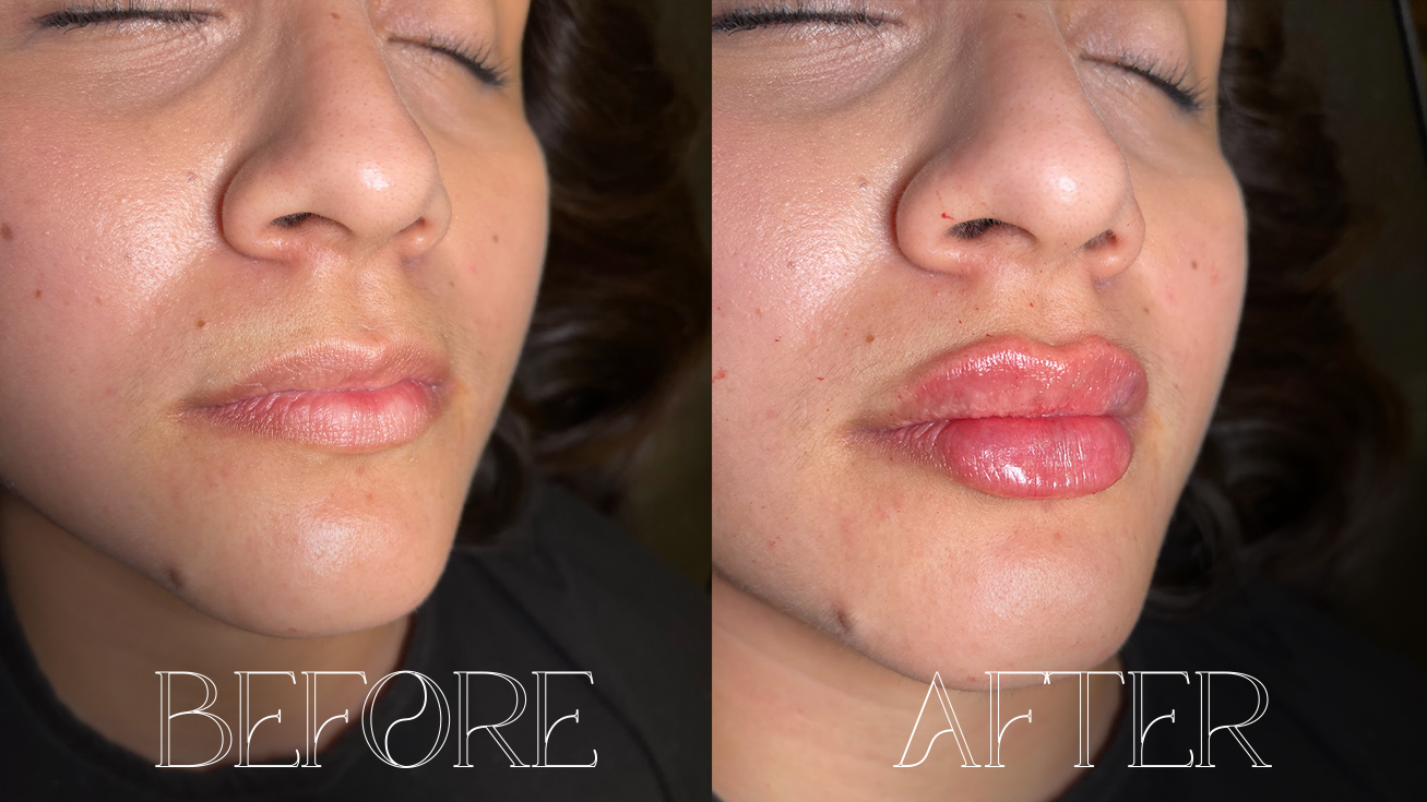 BEFOREAFTER1
