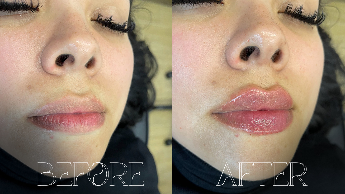 BEFOREAFTER2
