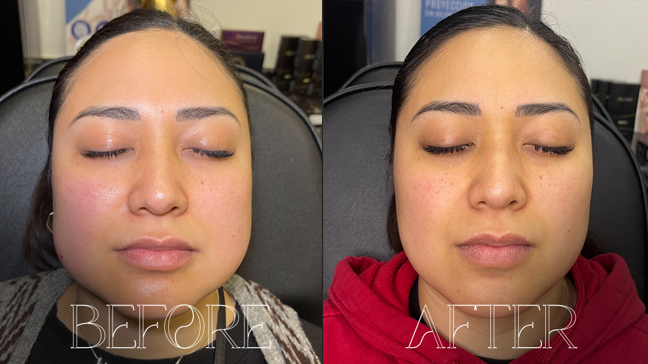 BEFOREAFTER3